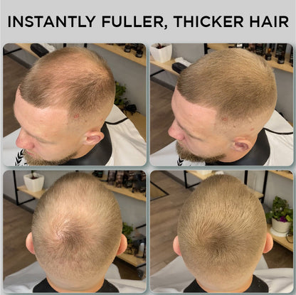 Hair Fibres 25g – Pack of 2