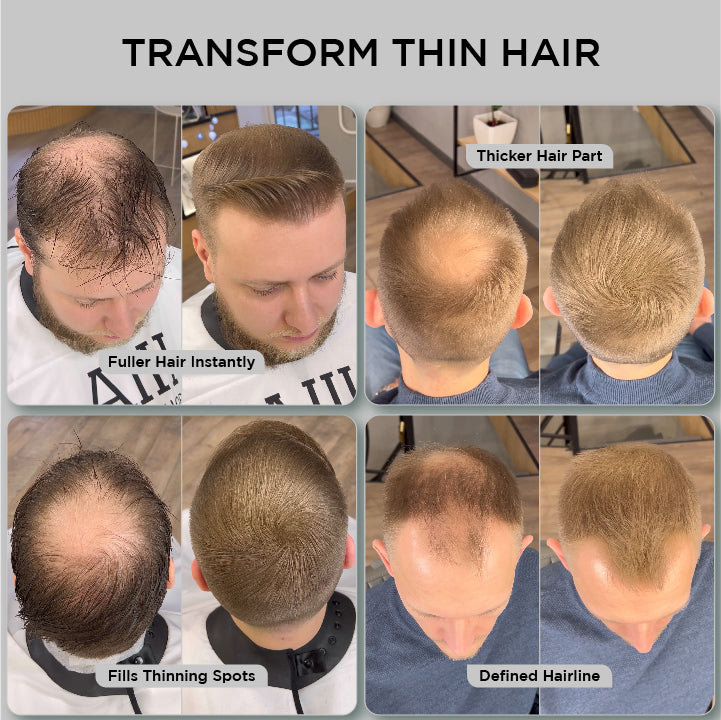 Hair Fibres 25g - Single Bottle