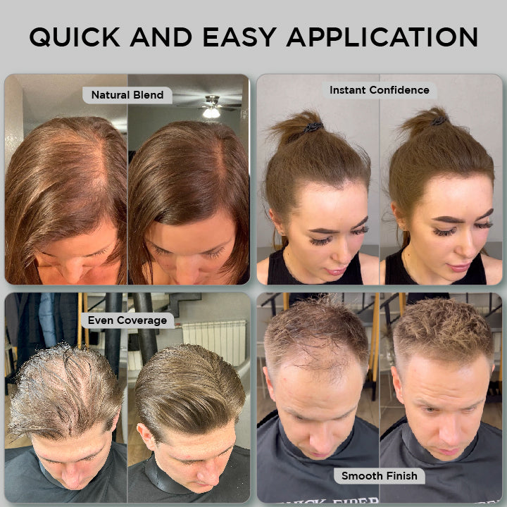 Hair Fibres 25g – Pack of 3