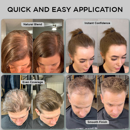 Hair Fibres 25g – Pack of 3